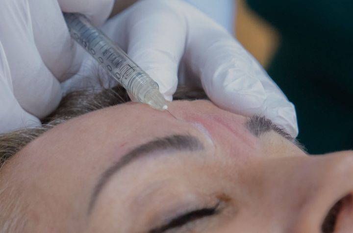 How to Get the Best Results from Botox